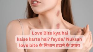love bite matlab in Hindi meaning